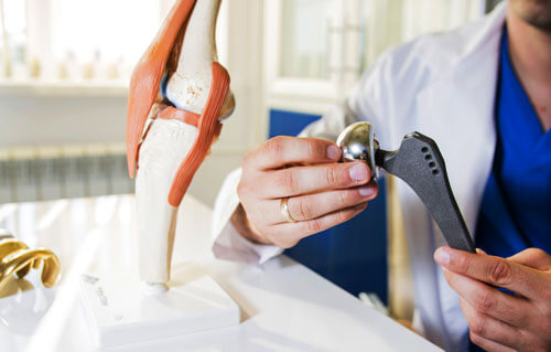 Revision Total Knee and Hip Replacement